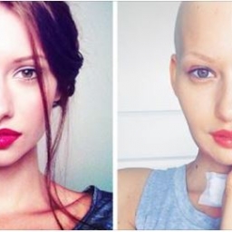Modelka w tym samym czasie dowiedziała się, że jest w ciąży i że ma raka. Jej re