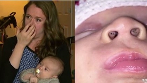 Już miała nakarmić swoje dziecko piersią, gdy zobaczyła w jego nosie dziwne, cza