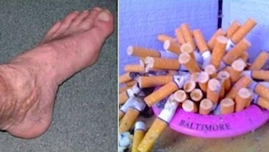 Co dzieje się w ciele człowieka po rzuceniu palenia.