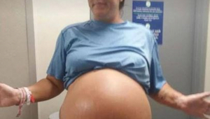 Lekarze głośno się roześmiali w trakcie jej porodu, kiedy zobaczyła powód, od ra