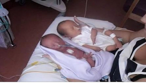 Oczekiwali narodzin bliźniaczek. Zmroziło ich ze strachu, gdy po porodzie lekarz