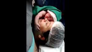 Po porodzie przez cesarskie cięcie, kobieta przytuliła noworodka, jego zachowani