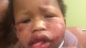Policja bada straszne pobicie rocznego dziecka przez inne dziecko w żłobku